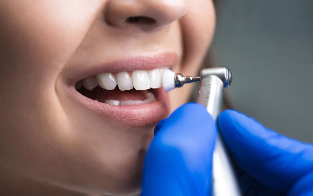 5 Ways to Improve Your Dental Hygiene Routine