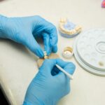 Dental Implants Tavistock